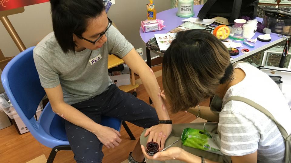 Volunteer having Psoriatic make up